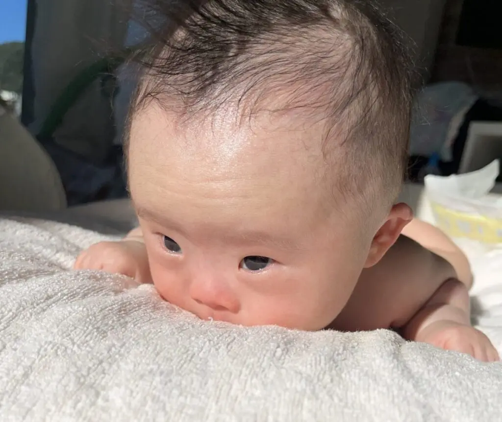 ダウン症 顔つき 新生児