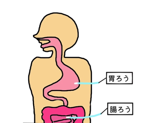 胃ろうと腸ろうの違いを表したイラスト