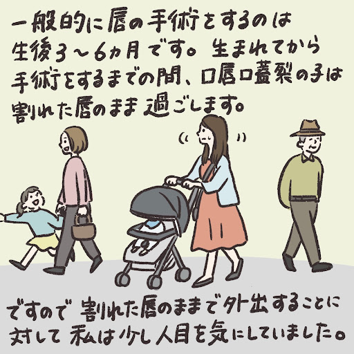 一般的に唇の手術をするのは、生後3〜6ヵ月です。生まれてから手術をするまでの間、口唇口蓋裂の子は割れた唇のまま過ごします。ですので割れた唇のままで外出することに対して私は少し人目を気にしていました。