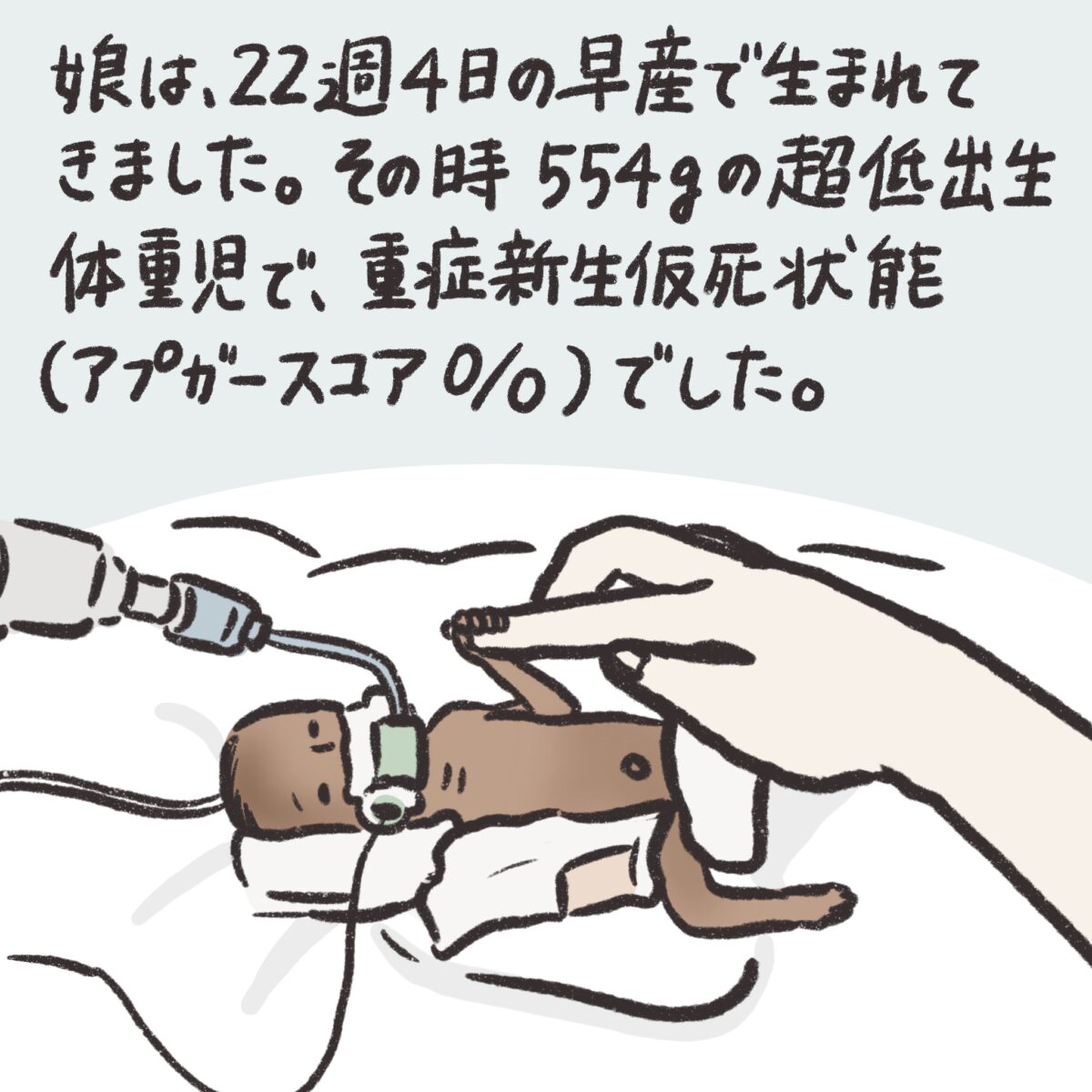 娘は、22週4日の早産で生まれてきました。その時554gの超低出生体重児で、重症新生児仮死状態でした。