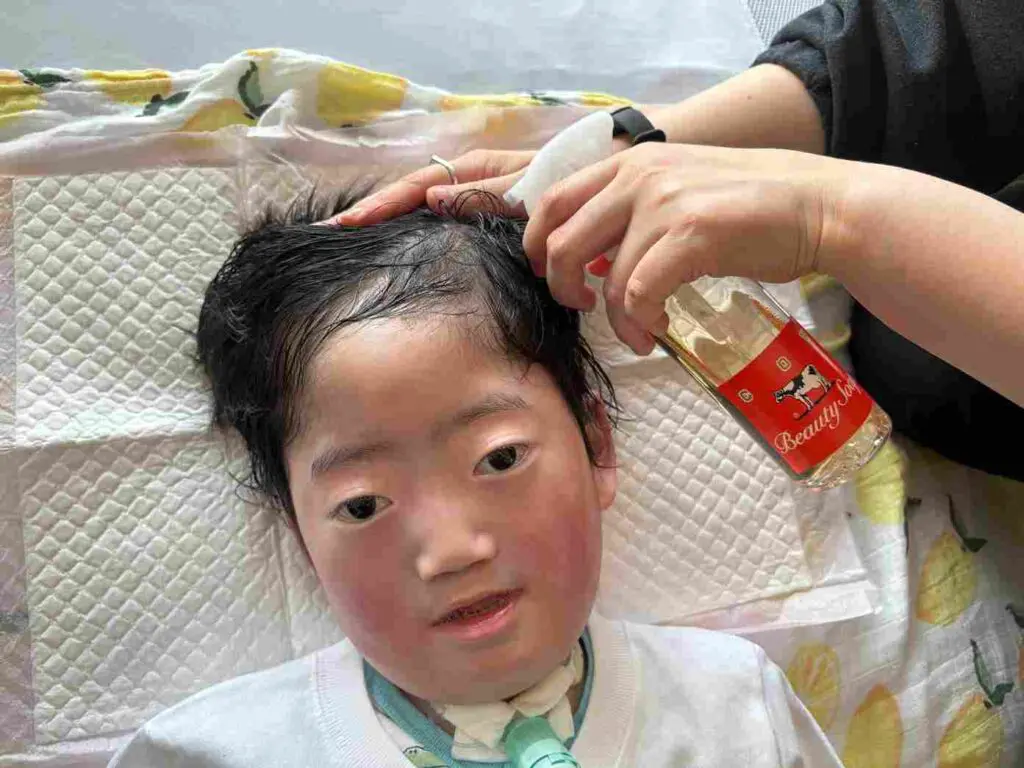 レポ】寝たままでも髪を洗えるSUSUGU（ススグ）を肢体不自由児が使って