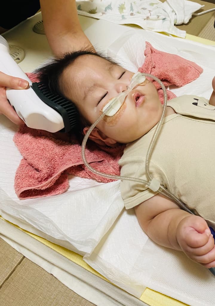 ネーザルハイフローをつけた女の子が横になり、タオルの上に頭を乗せている。親御さんがその状態のお子さんにSUSUGUの機器をあてて洗髪している。