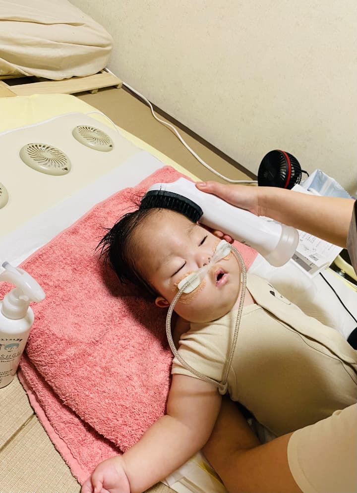 ネーザルハイフローをつけた女の子が横になり、タオルの上に頭を乗せている。親御さんがその状態のお子さんにSUSUGUの機器をあてて洗髪している。