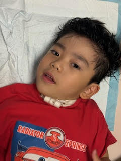 気管切開をした男の子が防水シーツの上に頭をのせた状態で横になっている